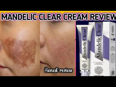 Mandelic Clear Cream Review by Expert – Dark Spots Melasma Freckles Pigmentation Removing Challenge